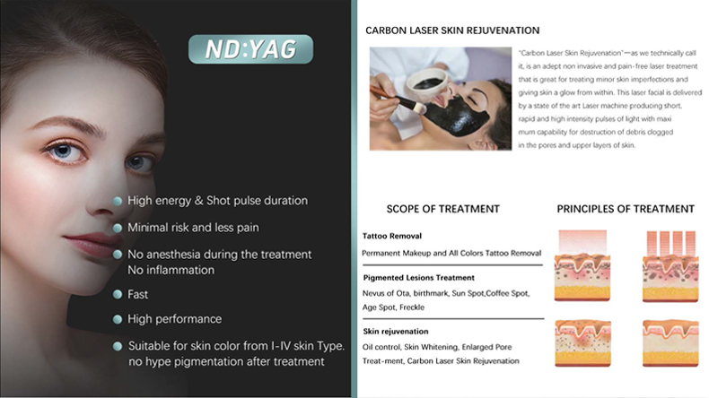 Remo&ccedil;&atilde;o de tatuagem a laser