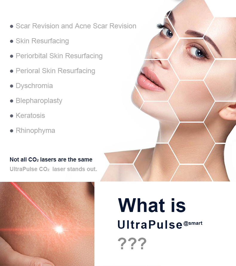 Laser cir&uacute;rgico