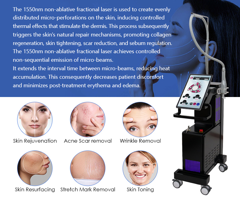 1550nm de vidro de erbio&nbsp; Laser&nbsp;